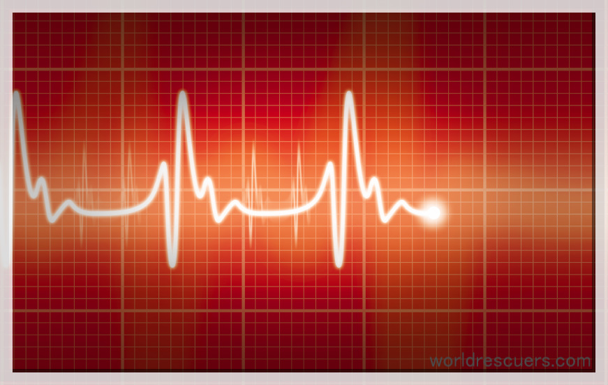 diastolic heart failure